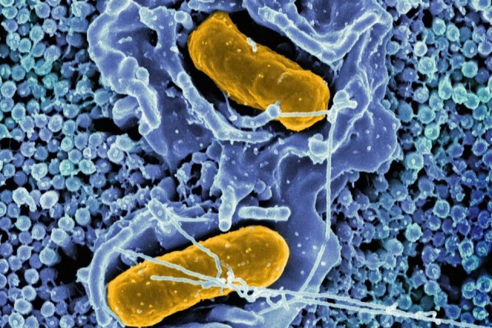 Kunnen condooms schimmelinfecties veroorzaken?