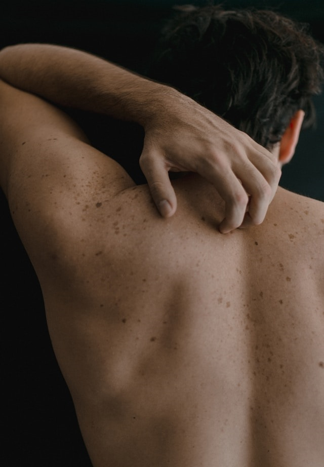 Type IV allergie is een type allergie voor latex. In deze producten komt latex voor; huishoudelijke artikelen zoals elastiekjes, huishoudhandschoenen en zelfklevende enveloppen. Het zijn verborgen bronnen die latex bevat. Door specifieke ige antistoffen uit dierlijk sap kunnen verschijnselen overgaan. Type IV allergie is een type allergie voor latex. In deze producten komt latex voor; huishoudelijke artikelen zoals elastiekjes, huishoudhandschoenen en zelfklevende enveloppen. Het zijn verborgen bronnen die latex bevat. Door specifieke ige antistoffen uit dierlijk sap kunnen verschijnselen overgaan.